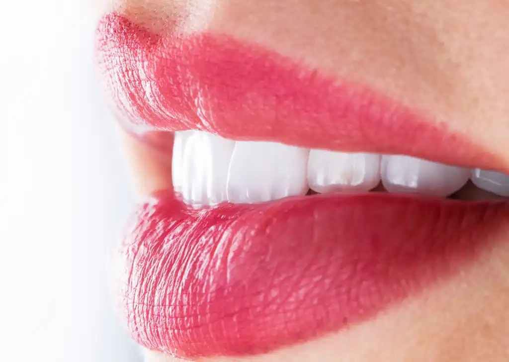 Porcelain Crowns – What are the Characteristics?